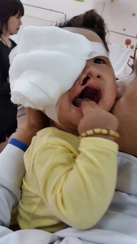 Xót xa khuôn mặt đa dị tật của bé trai 6 tháng tuổi - 2